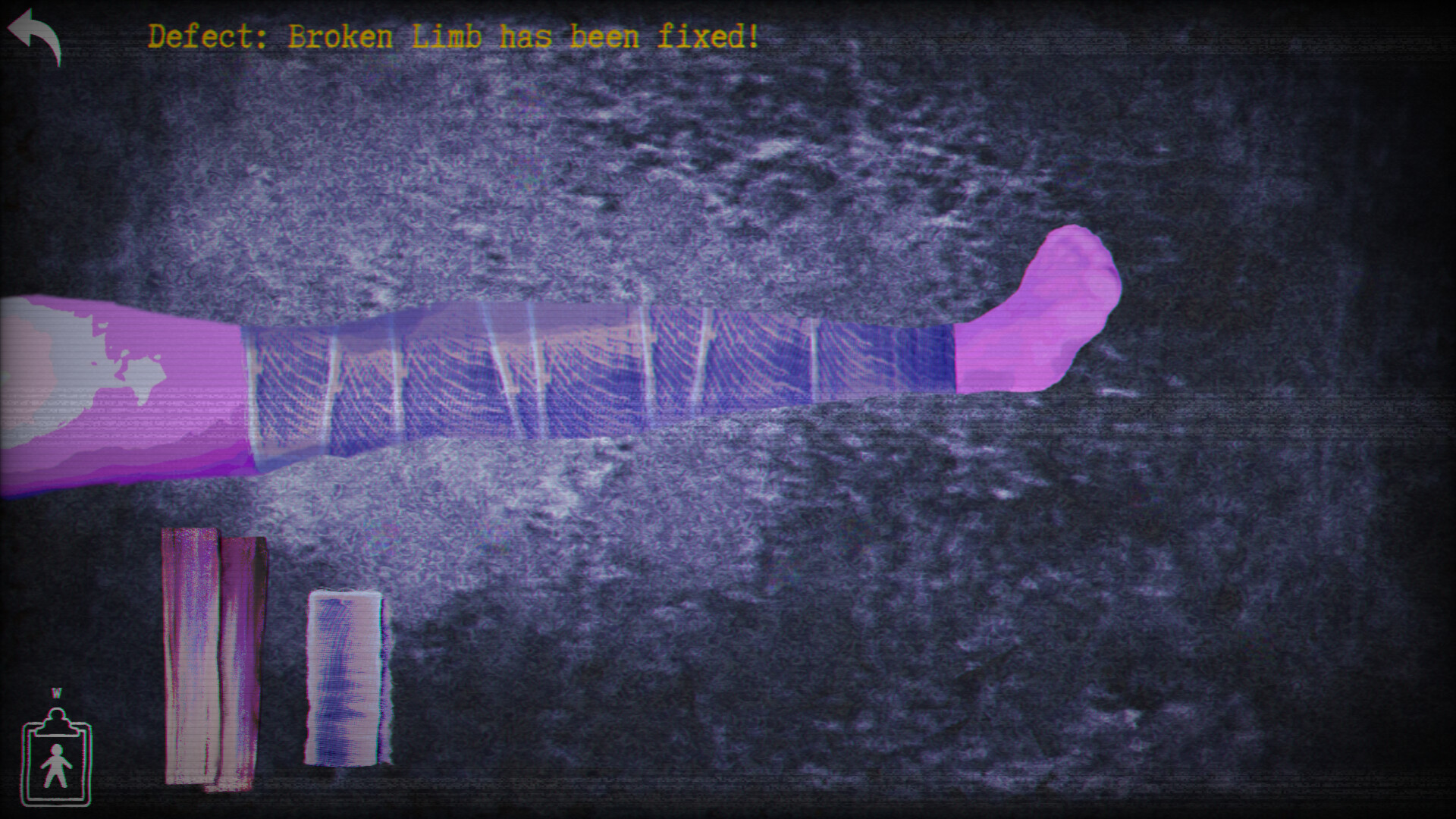 Surgical simulation scene from Smile More game showing fixed broken limb.